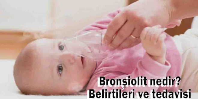 Bronşiolit nedir? Belirtileri ve tedavisi