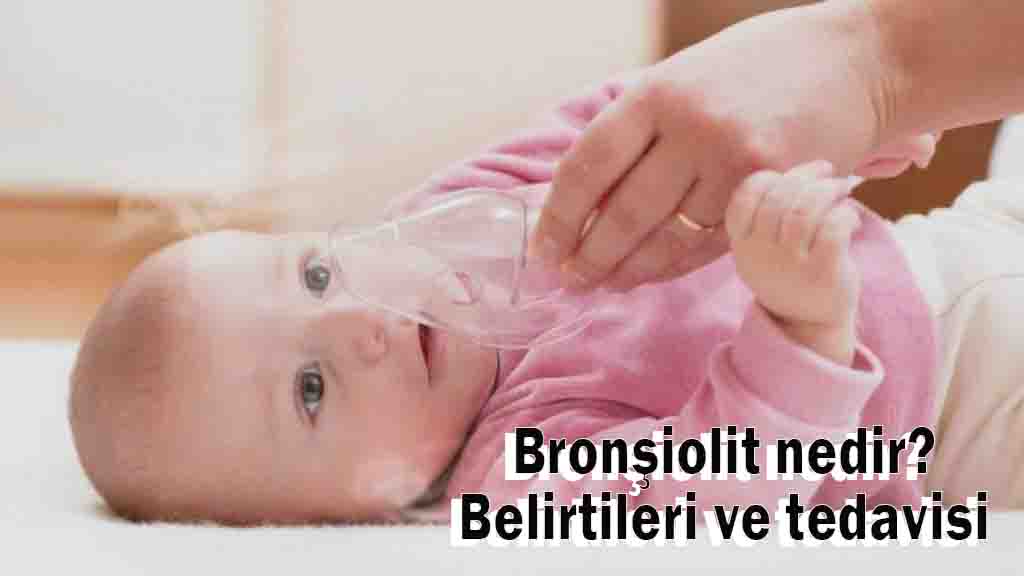 Bronşiolit nedir? Belirtileri ve tedavisi