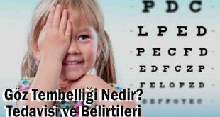 Göz Tembelliği Nedir? Belirtileri ve Tedavisi