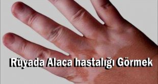 Rüyada Alaca hastalığı Görmek