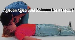 Ağızdan Ağıza Suni Solunum Nasıl Yapılır?